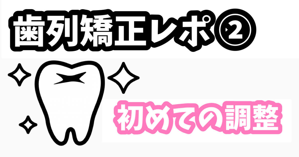 歯列矯正レポ